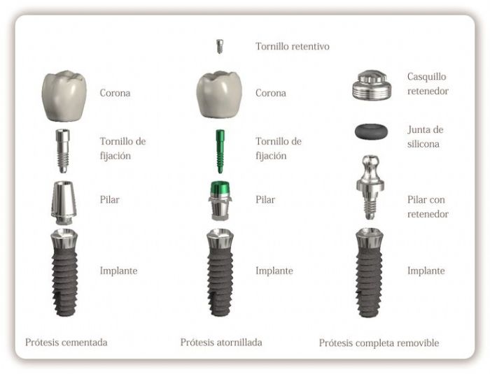 Implante Dental 3.2mm
